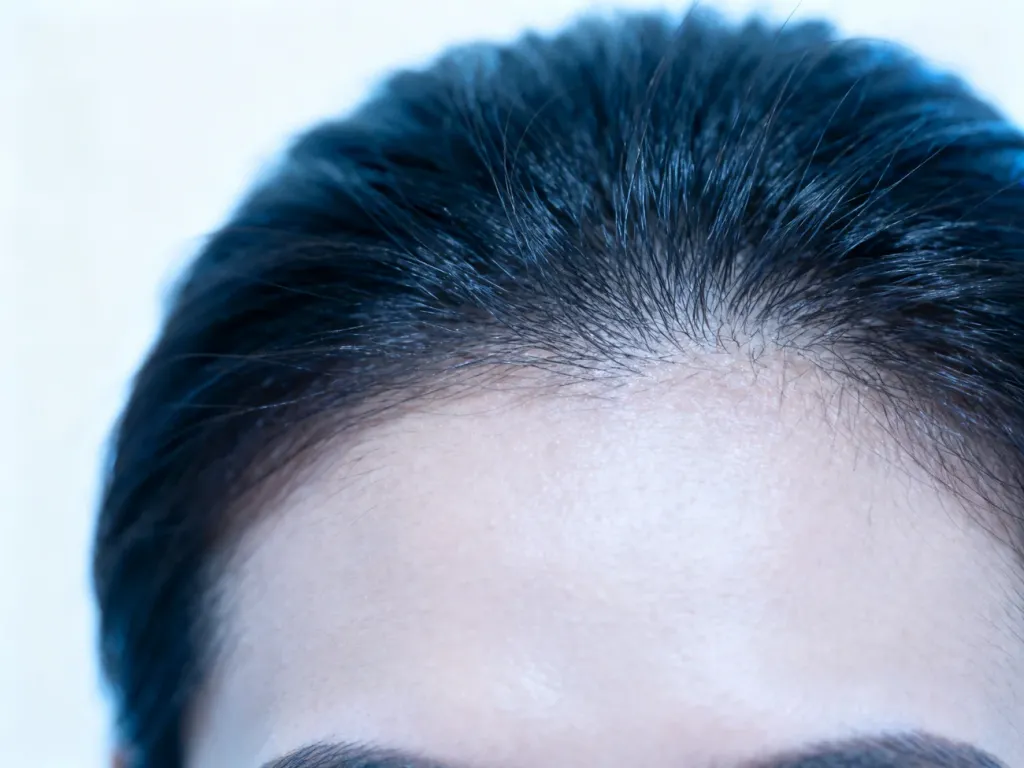 Zbliżenie na zdrową skórę głowy i włosy w sterylnym, klinicznym oświetleniu, podkreślające higienę i dermatologiczny aspekt.